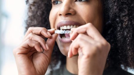 invisalign