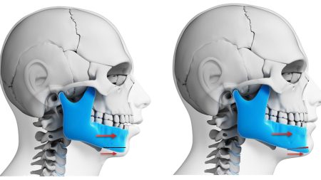 surgical-orthodontics