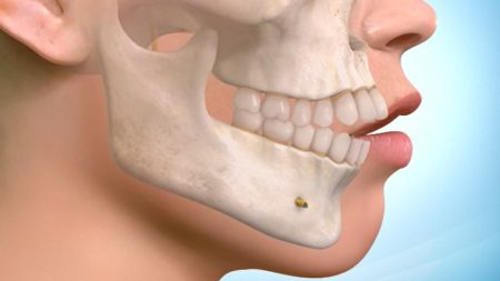 surgical-orthodontics