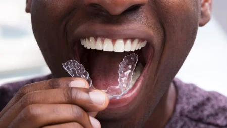 black-man-with-invisalign.jpg