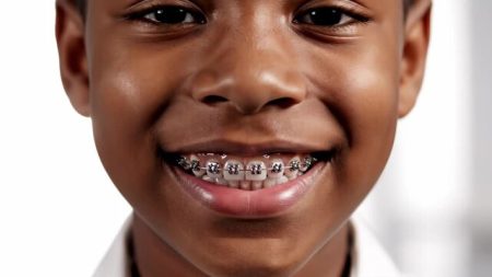 braces